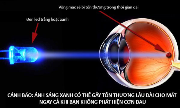 Màn hình LED có ảnh hưởng tới thị lực không? Sự thật bạn cần biết tac hai anh sang xanh 600x360 1